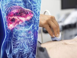 El hígado graso: una epidemia silenciosa que desafía los análisis médicos rutinarios