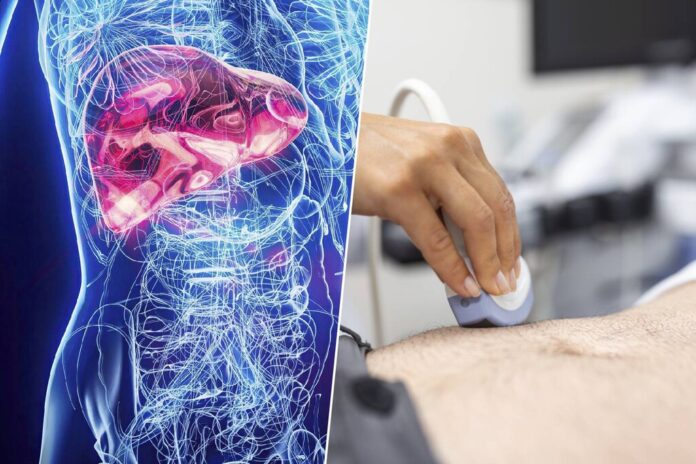El hígado graso: una epidemia silenciosa que desafía los análisis médicos rutinarios