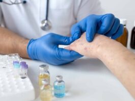 OPS: aumenta casos de Sarampión en las Américas