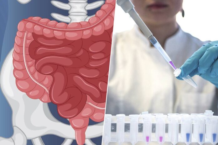 El cáncer de colon ya no es cosa de mayores: los casos en jóvenes se disparan y la ciencia apunta a nuestro estilo de vida