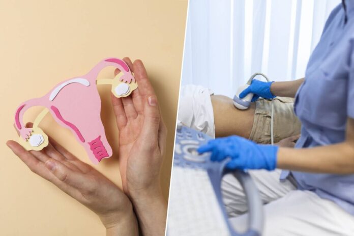 Estamos diagnosticando mal el síndrome de ovario poliquístico. Por eso, estos científicos han propuesto cambiarlo de nombre